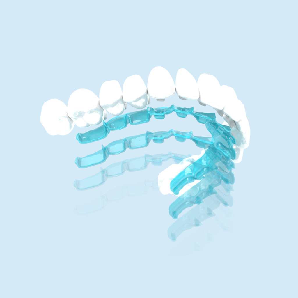 Works like clear aligners